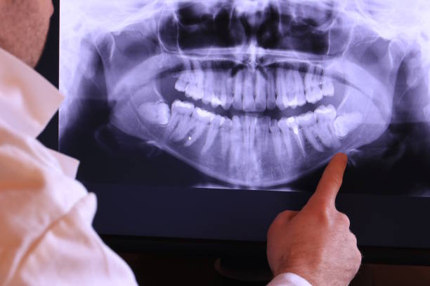 Best Emergency Wisdom Teeth Removal in Camilla, GA