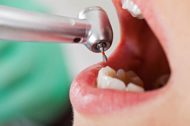 Best Emergency Tooth Extraction in Camilla, GA